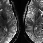 Illustration d’un cerveau humain symbolisant la connexion entre l’odorat et les émotions.